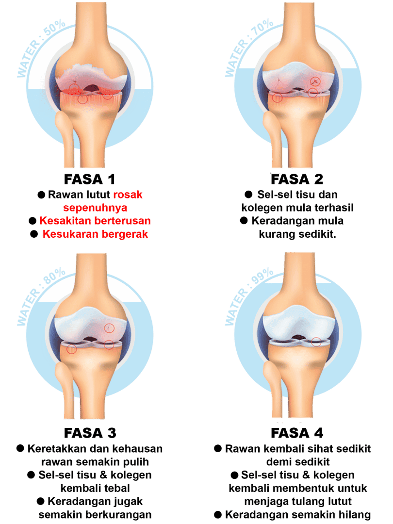 Biovytal-JointActiv-Osteorthritis-Fasa Biovytal-JointActiv-Osteorthritis-Fasa